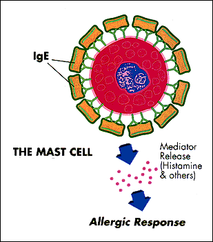 allergic reaction diagram