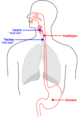 acid reflux throat