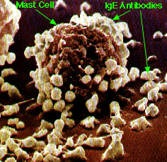 Mast Cells & IgE Antibodies